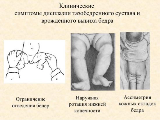 Ассиметрия детских ножек