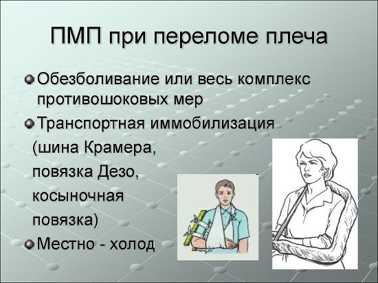 Помощь при переломе плеча